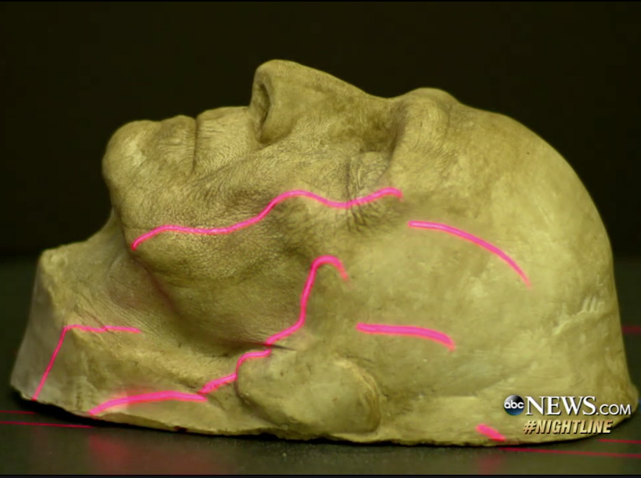 3D scanning of a human face